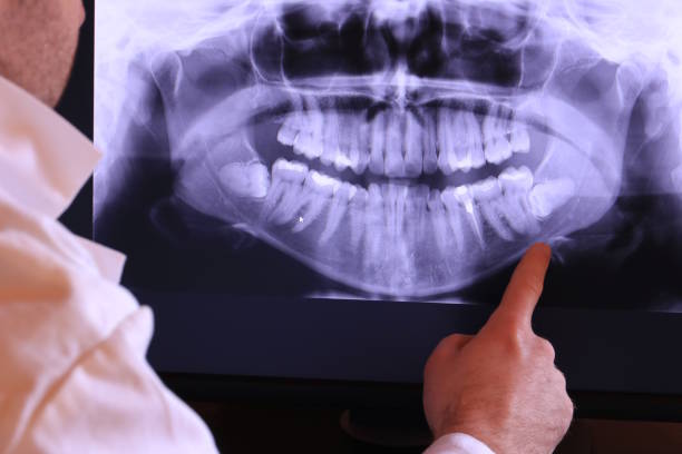 Best Emergency Broken Tooth Repair in Pocono Ranch Lands, PA
